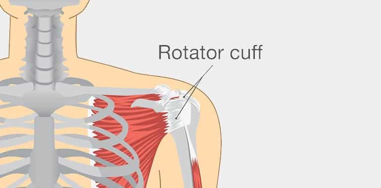 Rotator Cuff