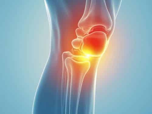 Knee Pain