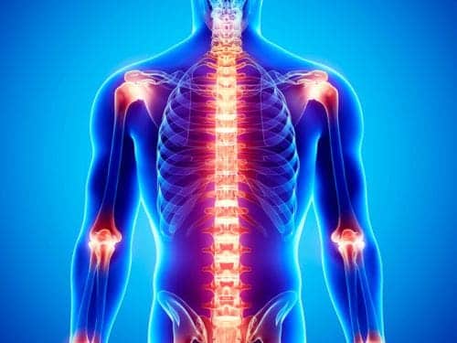 Chronic Pain